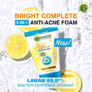 Garnier Bright Complete 3-in-1 Anti Acne Facial Wash