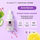 Scarlett Whitening Acne Serum