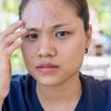 Menyamarkan Flek Hitam dan Bekas Jerawat