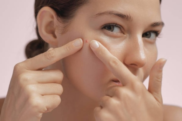 Jangan Langsung Salahkan Skincare yang Anda Pakai!